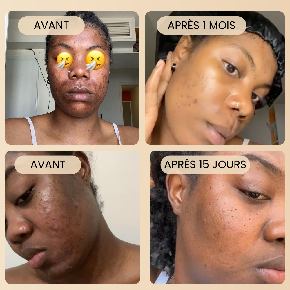 Masque au Curcuma "Anti-taches" + 1 pinceau applicateur OFFERT
