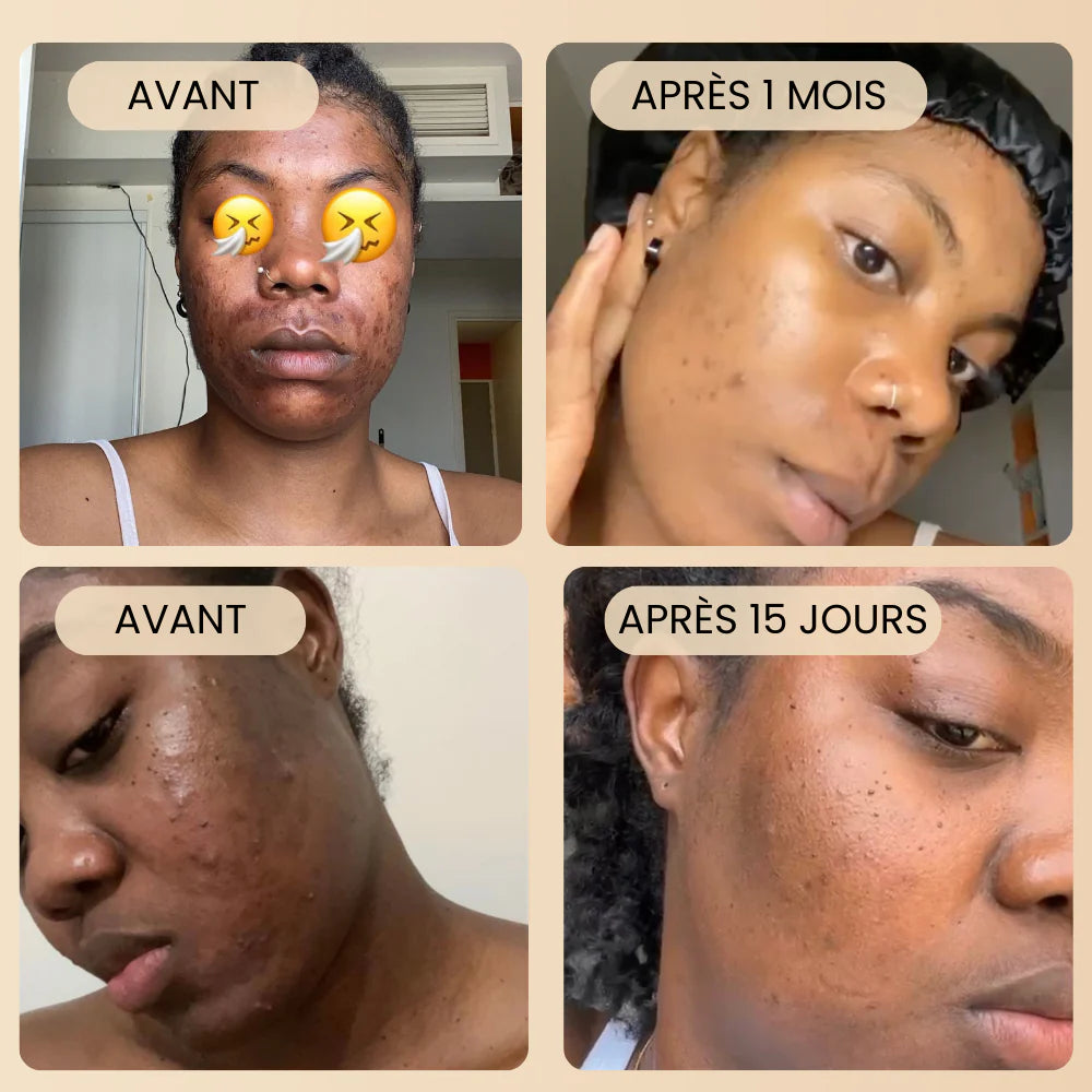 Pack hydratation "Anti-taches" + 1 pinceau offert