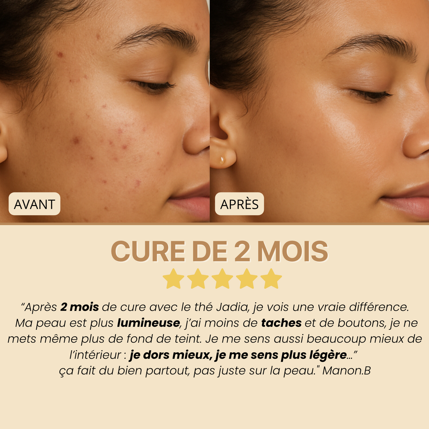 Glow Tea - Thé purifiant au curcuma & camomille l  Anti-taches et imperfections