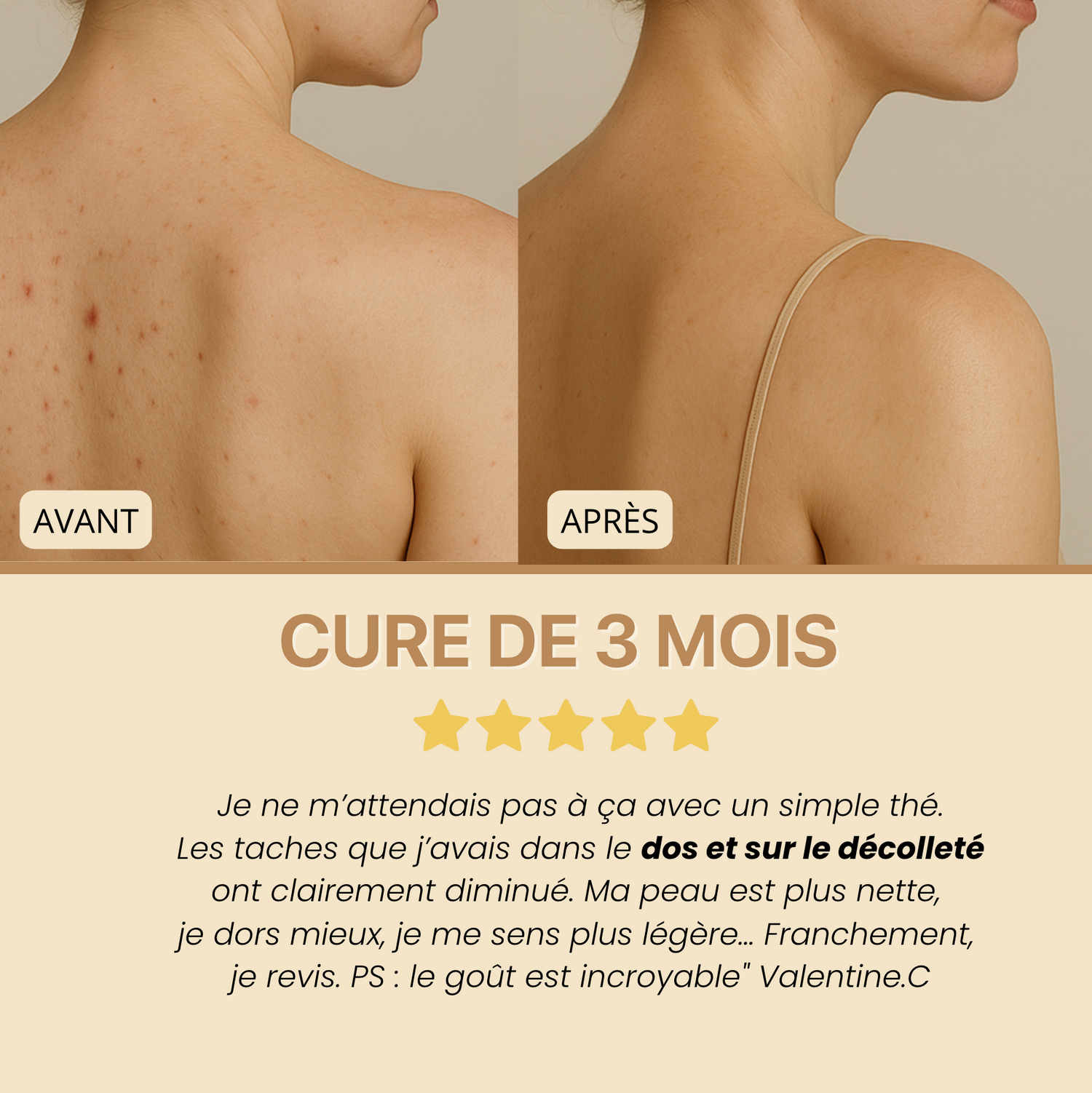 Glow Tea - Thé purifiant au curcuma & camomille l  Anti-taches et imperfections