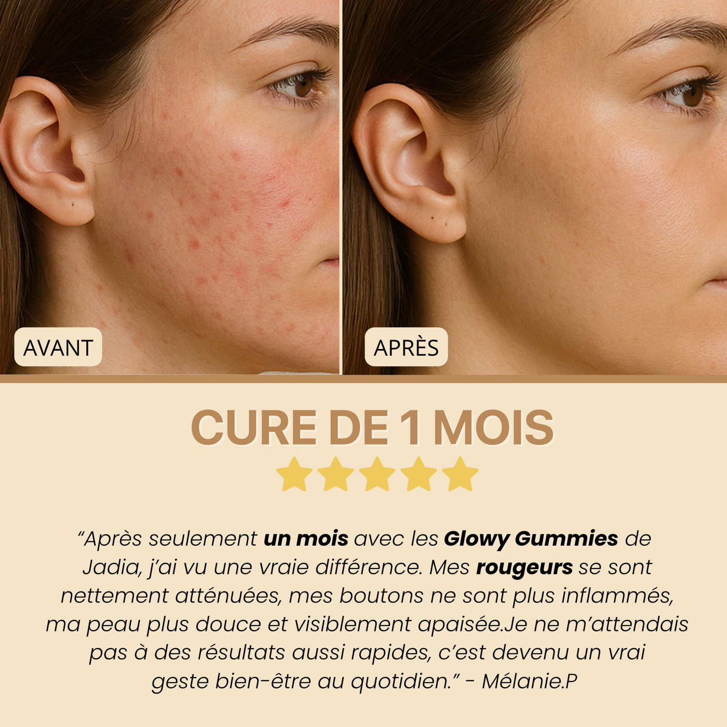 Glowy Gummies - Gummies au curcuma & vitamine C l Anti-taches et imperfections