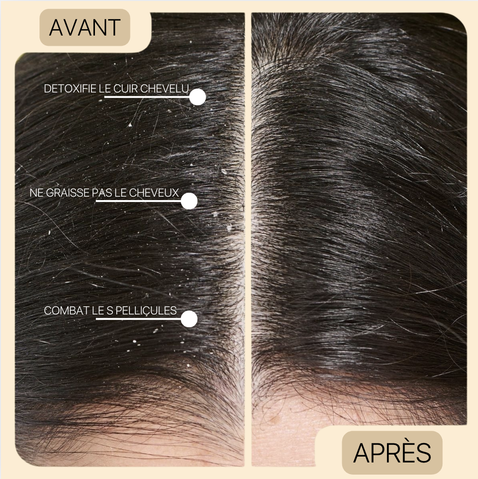Shampooing au Curcuma l Protège & Répare