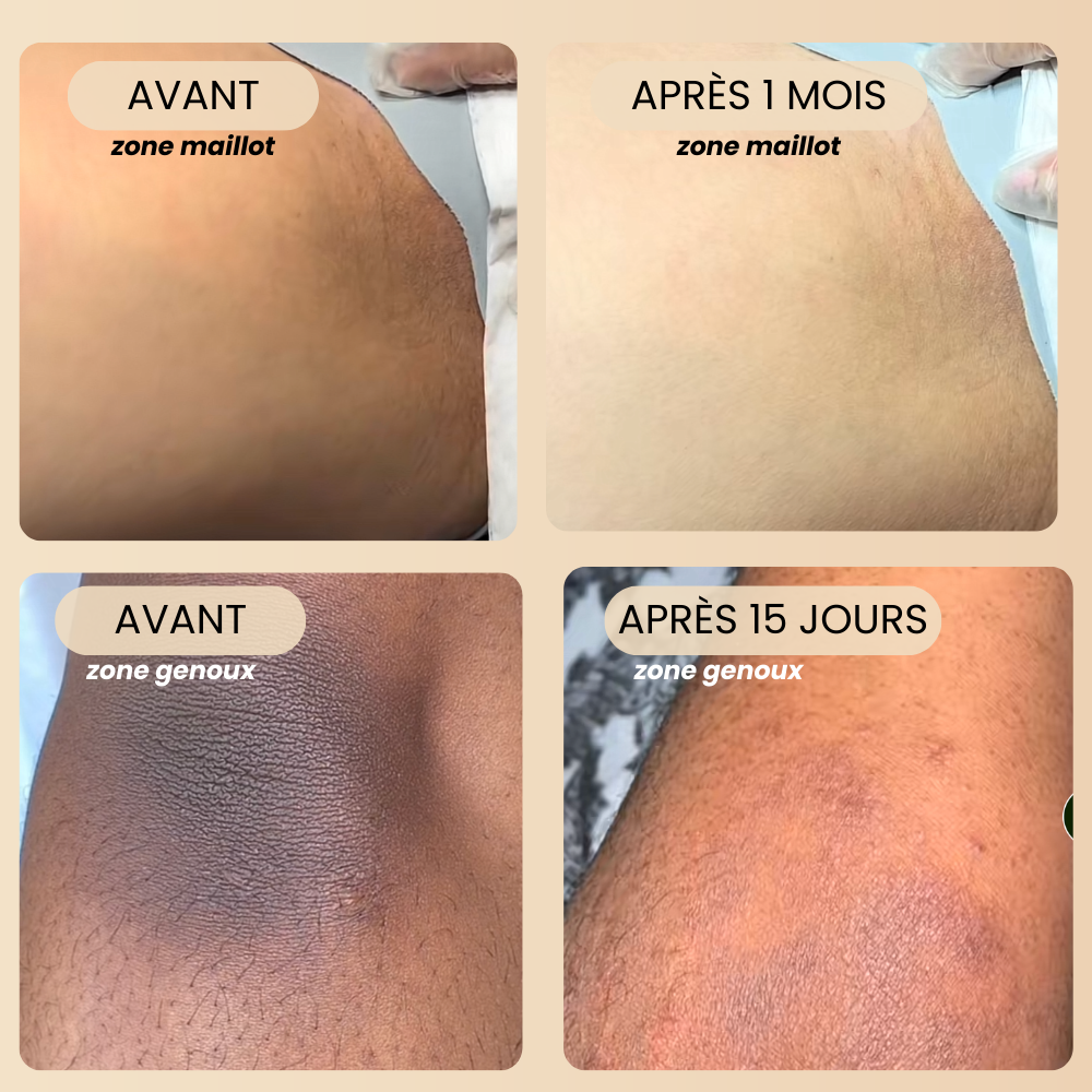 Savon au Curcuma hydratant corps et visage "Anti-taches"