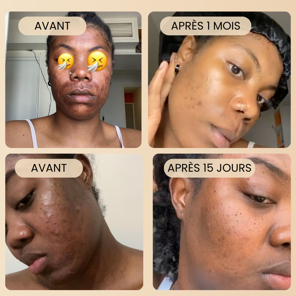 Masque au Curcuma &quot;Anti-taches&quot; - Jadia© + 1 pinceau applicateur OFFERT