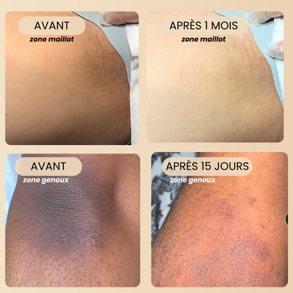 PACK HYDRATANT CORPS  &quot;Anti-taches&quot; - Jadia© + 1 sac à savon exfoliant OFFERT